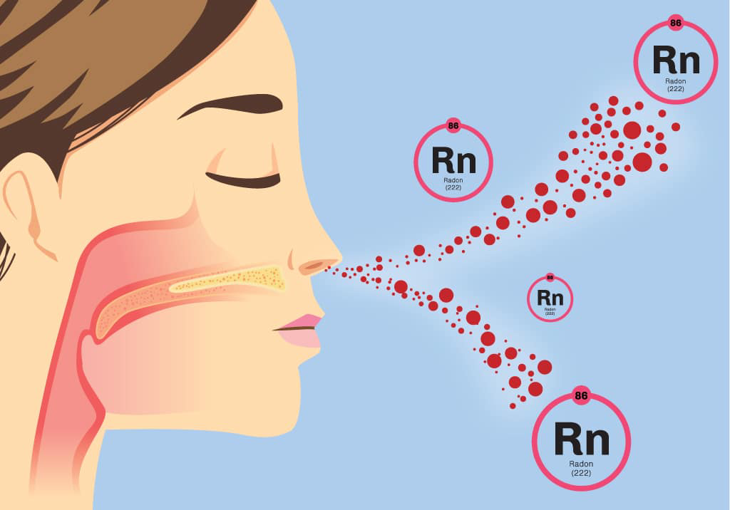 Symptoms of Radon Poisoning